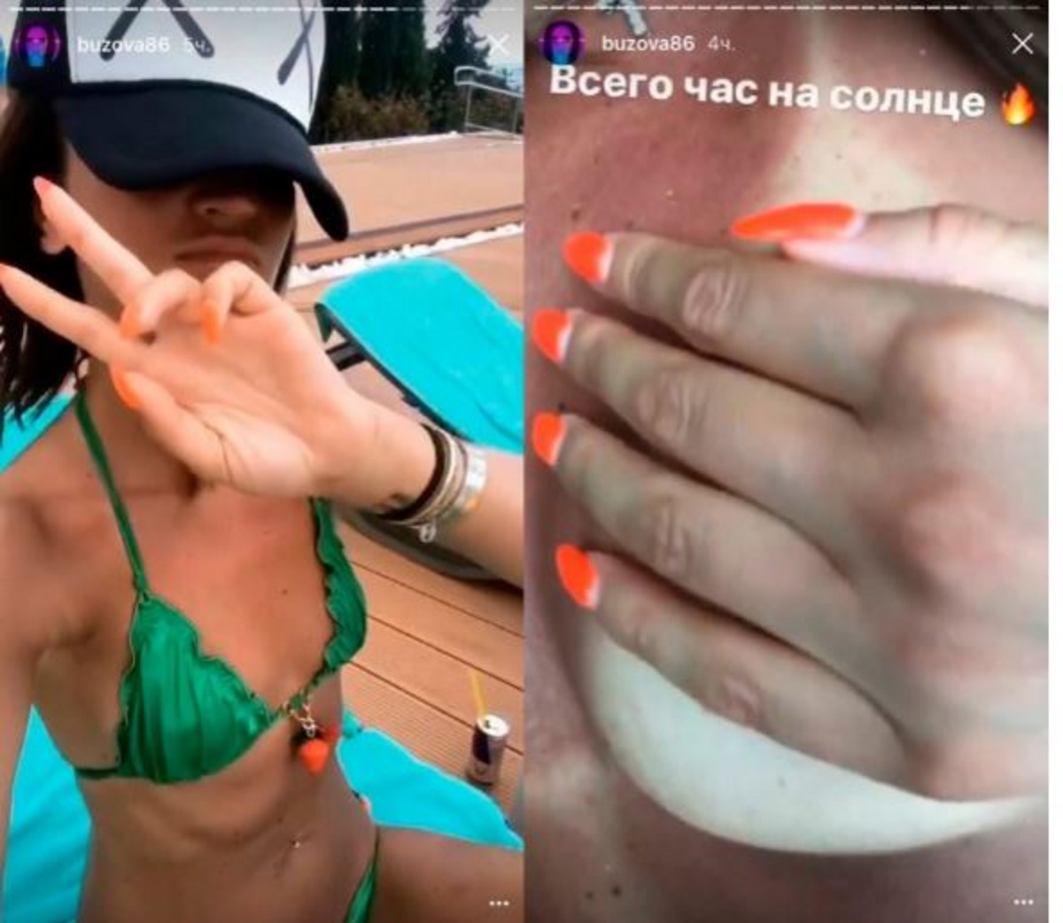 Бузова слив