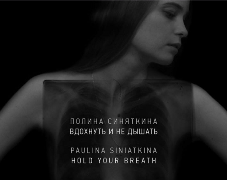 Живопись Полины и то, что она делает, — новый взгляд на проблему туберкулеза в России