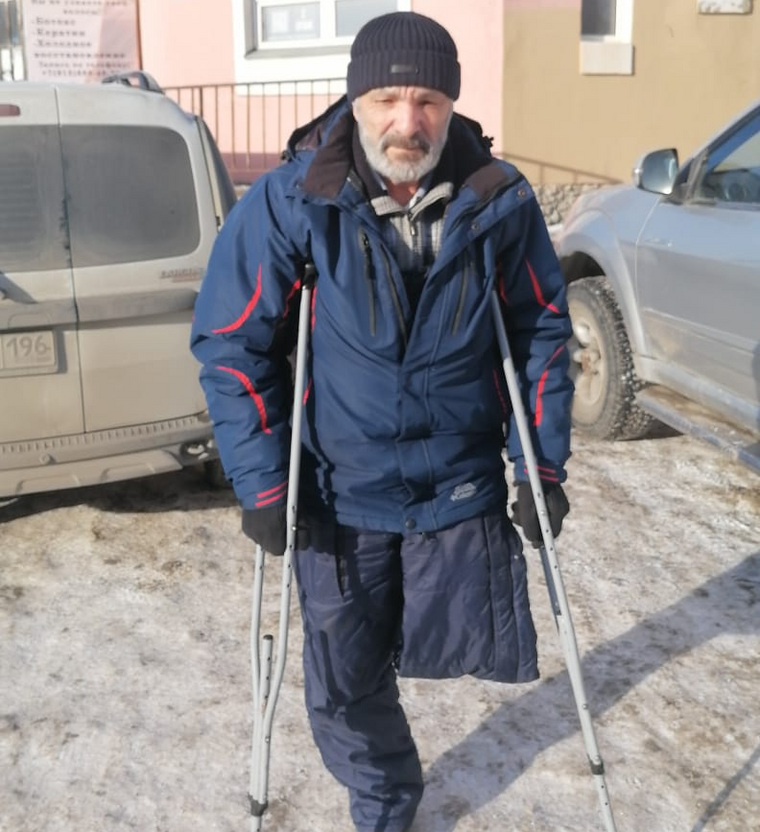 Мужчина уже четыре года как лишился ноги, но инвалидом его не признают