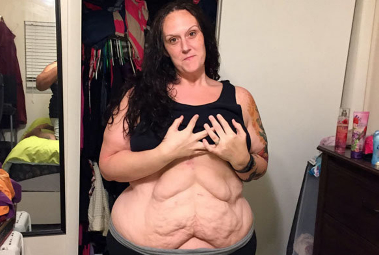 Женщина весила 150 килограммов
