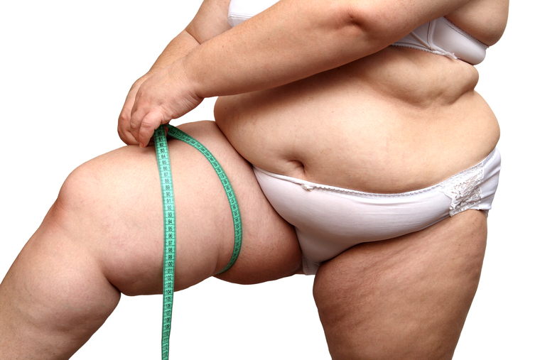 Клипарт depositphotos.com, жир, ожирение, толстые люди, полные люди, лишний вес