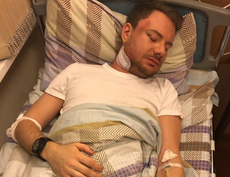 У звезды сломана челюсть, несколько черепно-мозговых травм