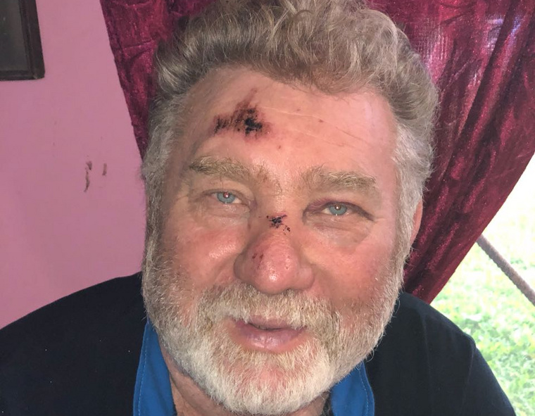 Пострадавший во всем винит мэра