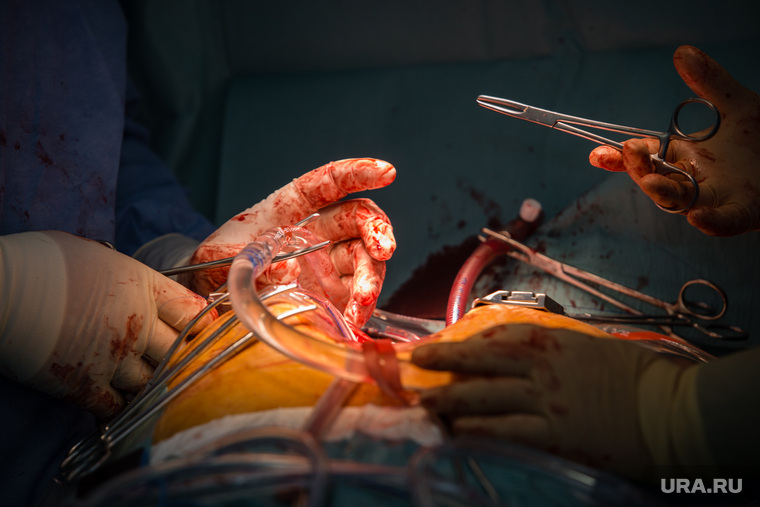Хирургическая операция в Окружном кардиологическом диспансере «Центр диагностики и сердечно-сосудистой хирургии». Сургут, операция, хирургия, руки хирурга