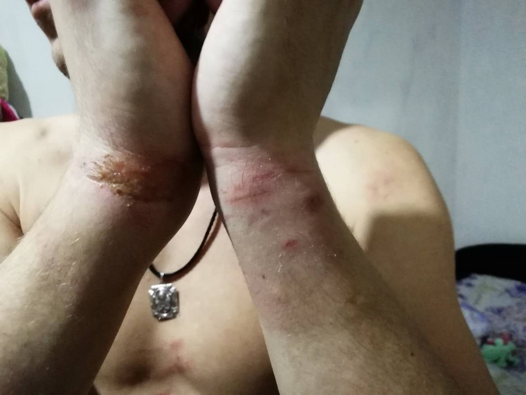 Червоткина несколько часов держали в наручниках
