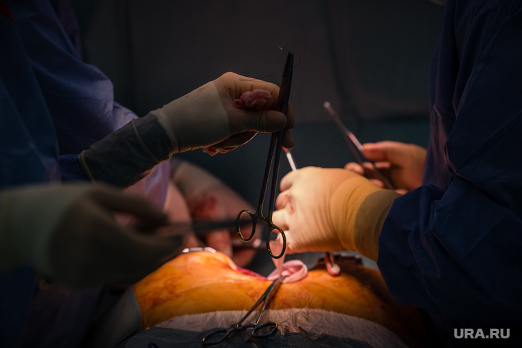 Хирургическая операция в Окружном кардиологическом диспансере «Центр диагностики и сердечно-сосудистой хирургии». Сургут, хирургия, операция, медицинские инструменты, зажим, руки хирурга
