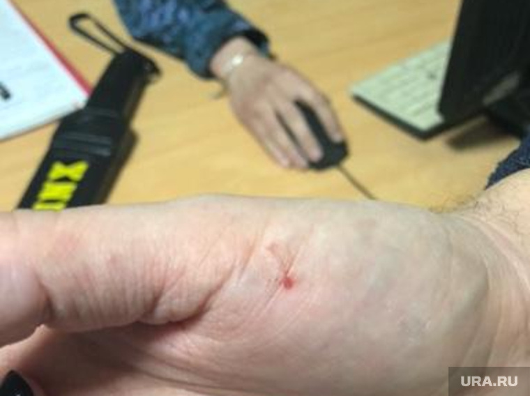 На запястье мужчины остались следы от наручников