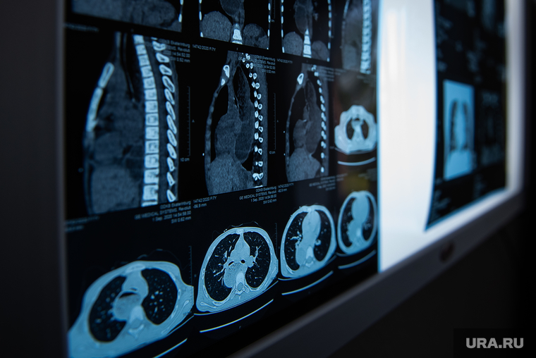 Открытие нового кабинета компьютерной томографии в областной детской клинической больнице. Екатеринбург, рентген, снимок, рентгеновский снимок, томограмма