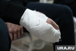 Пострадавшему наложили швы на раненую руку (архивное фото)