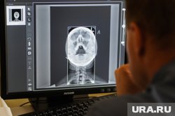 Медобследование не выявило у ребенка признаков черепно-мозговой травмы