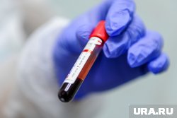 Челябинцы изучили механизм, по которому сок папайи заставляет вырабатываться тромбоциты крови 