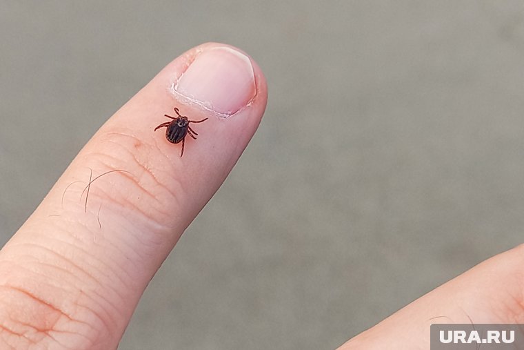 От укусов клещей пострадали уже 4164 югорчанина