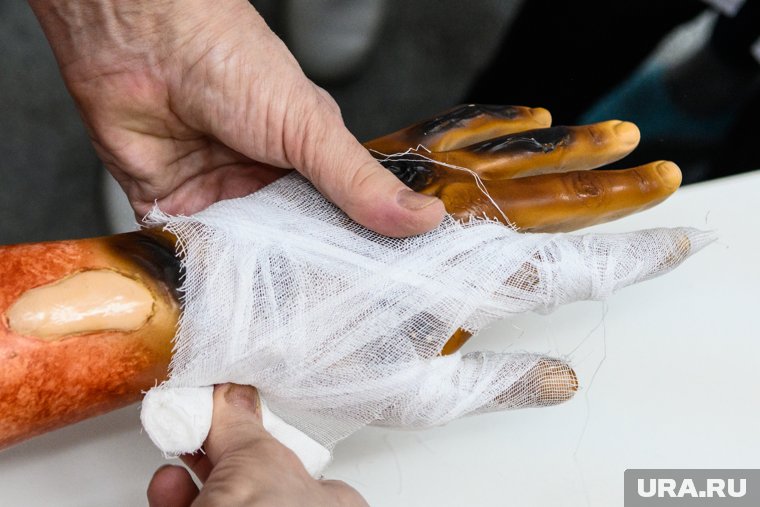 В Петербурге две женщины получили химический ожог