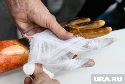 В Петербурге две женщины получили химический ожог