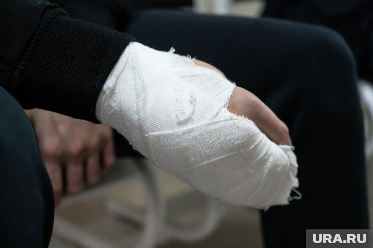 Работодатель с силой открыл дверь, которая неожиданно ударила мужчину