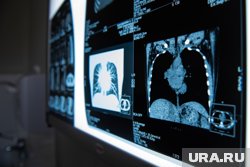 При осложнениях врач может назначит рентген поврежденной части тела