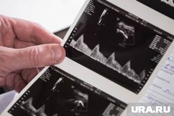 В регионе число абортов снизилось на 20%