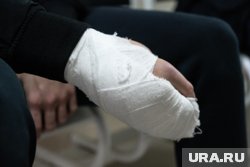 У пострадавшего — ампутация первого и частично второго пальцев левой кисти, а также тотальный некроз 