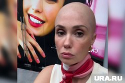 Беременная Агата Муцениеце стала лысой