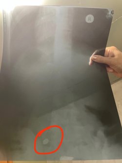 Запчасть оказалась в кишечнике
