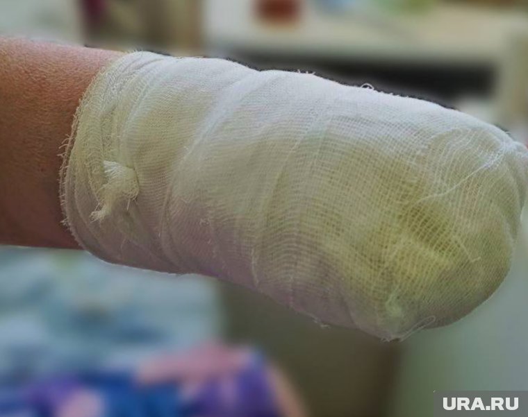 Студенту на Тайване ампутировали конечности после того, как тот пытался обмануть страховые компании 