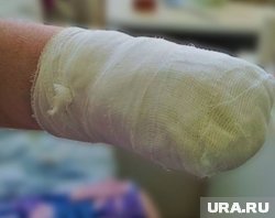 Студенту на Тайване ампутировали конечности после того, как тот пытался обмануть страховые компании