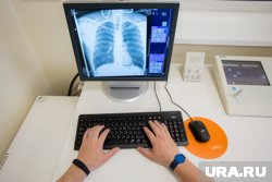 Трехлетний ребенок проглотил кольцо, которое врачи ХМАО достали без операции 