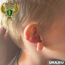  Ребенку причинена неизгладимая травма в виде травматической ампутации