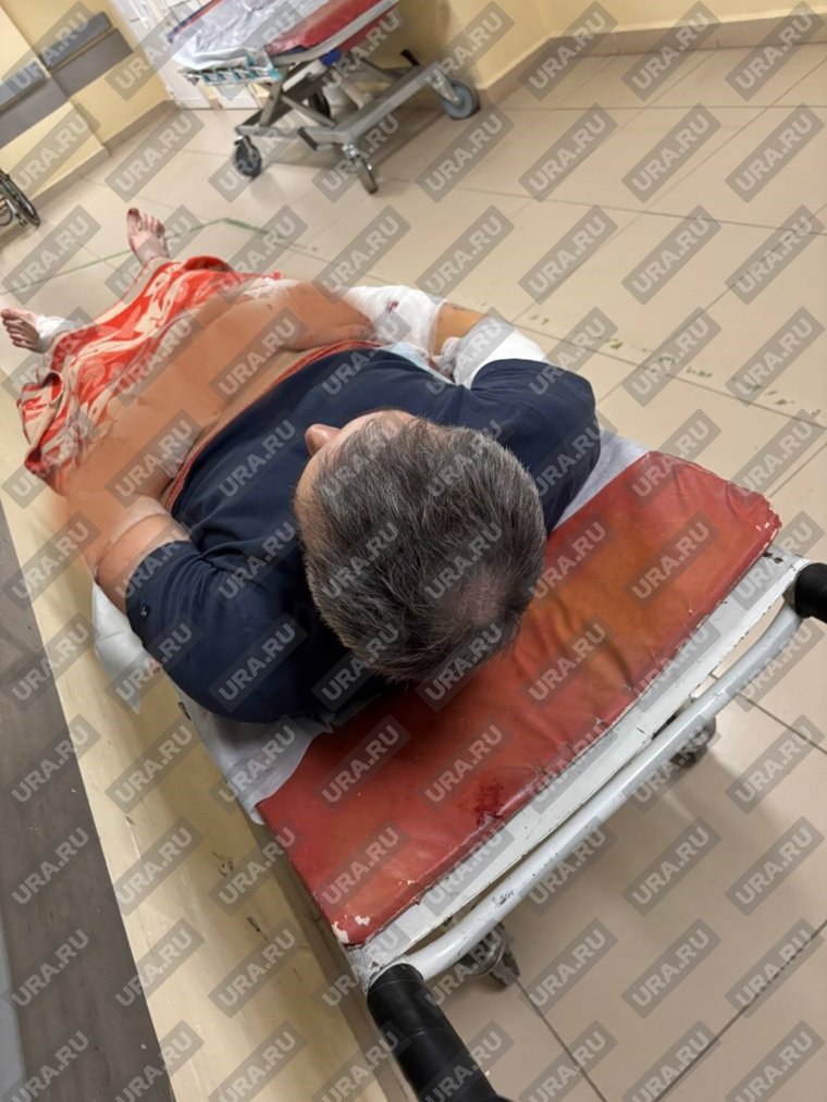 Пострадавший от нападения собак получил серьезную травму левой руки