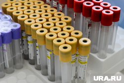 20 сентября — Всемирный день донора костного мозга