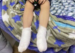 3-летнему мальчику младший воспитатель вылила кипяток на ноги