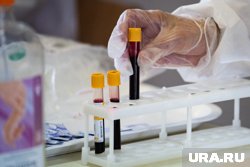 Соединения PFAS увеличивают риск развития онкологии и других заболеваний