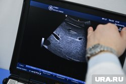 Врачи спасли женщину, у которой после перелета печень выпала в грыжевой мешок