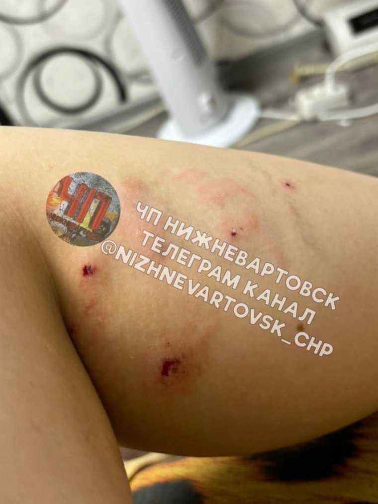 В Нижневартовске домашняя собака покусала девочку