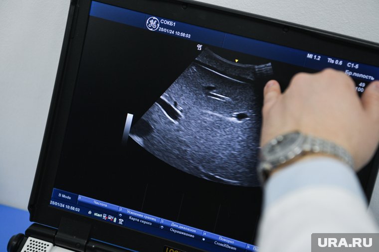 С инициативой компенсировать платные медицинские услуги выступили депутаты СРЗП
