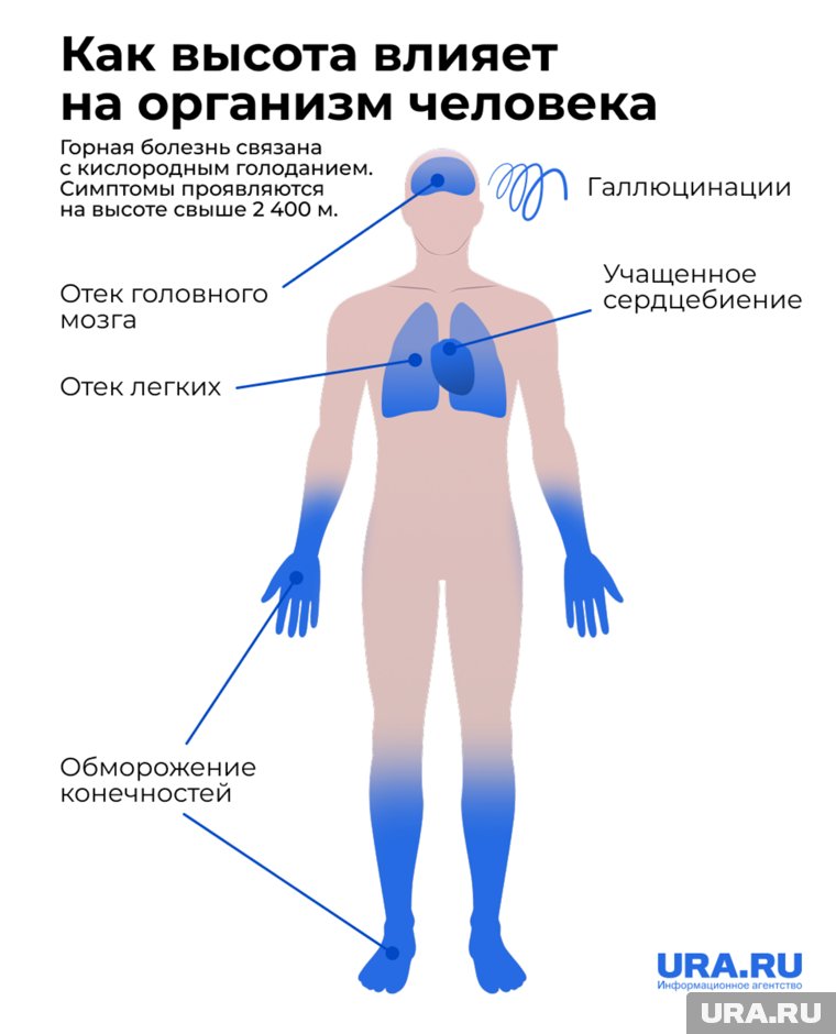Симптомы начинают проявляться на высоте более 2400 метров 
