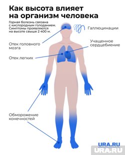 Симптомы начинают проявляться на высоте более 2400 метров 