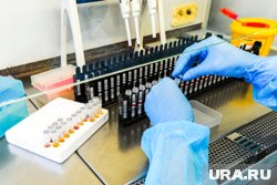 Специалисты рекомендуют проходить лабораторные обследования 