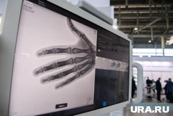 Флюорограф помогает диагностировать пневмонии и аномалии костно-суставной системы (архивное фото)