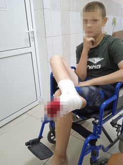 В Кетово мальчику отрезало палец во время игры в мяч на стадионе 