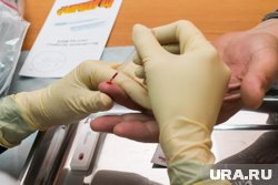 В 2023 году в Пермском крае выявлено свыше 1,8 тысяч случаев заражений ВИЧ-инфекцией