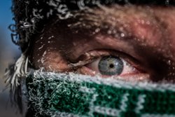 У женщин гетерохромия встречается чаще. Но у мужчин — более выражена