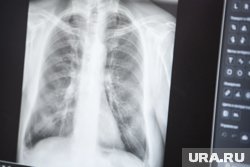 Ямальские рентгенологи прочитали более 1,5 тысяч снимков пациентов из Волновахи в 2025 году
