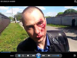 Так Александр Брюханов выглядел после инцидента