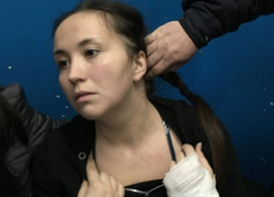 Девушка Анастасия Грушина, избитая полицейскими