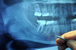 Открытая лицензия от 25.08.2015. Зубы , стоматология, зубы, рентген