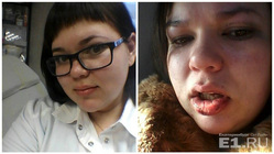 Девушка до и после избиения