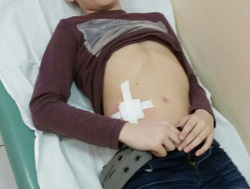 Резиновая пуля попала в 12-летнего мальчика, который возвращался домой с тренировки