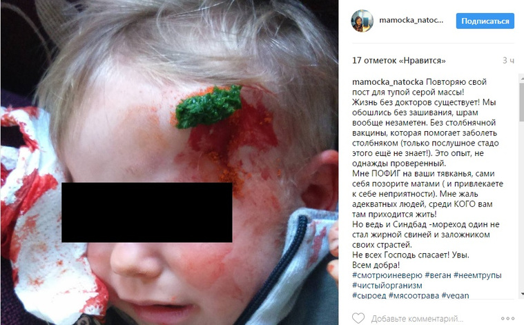 Сложную травму мать лечить народными средствами
