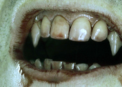 Открытая лицензия от 25.08.2015. Зубы , зубы, укус, клыки